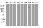 USP36 Antibody in Western Blot (WB)