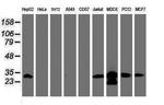 PSMA6 Antibody in Western Blot (WB)