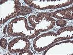 PSMA6 Antibody in Immunohistochemistry (Paraffin) (IHC (P))