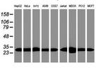 PSMA6 Antibody in Western Blot (WB)