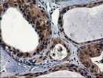 CNOT4 Antibody in Immunohistochemistry (Paraffin) (IHC (P))