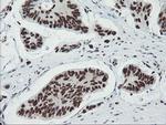 TPRKB Antibody in Immunohistochemistry (Paraffin) (IHC (P))