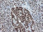 TPRKB Antibody in Immunohistochemistry (Paraffin) (IHC (P))