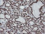 TPRKB Antibody in Immunohistochemistry (Paraffin) (IHC (P))