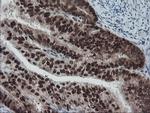 TPRKB Antibody in Immunohistochemistry (Paraffin) (IHC (P))