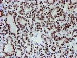 SLUG Antibody in Immunohistochemistry (Paraffin) (IHC (P))