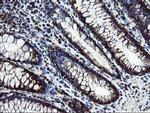 SnoN Antibody in Immunohistochemistry (Paraffin) (IHC (P))