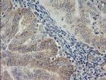 AGTPBP1 Antibody in Immunohistochemistry (Paraffin) (IHC (P))