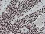 TPRKB Antibody in Immunohistochemistry (Paraffin) (IHC (P))