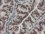 TPRKB Antibody in Immunohistochemistry (Paraffin) (IHC (P))