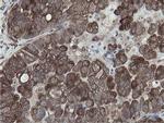 MIPEP Antibody in Immunohistochemistry (Paraffin) (IHC (P))