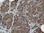 MIPEP Antibody in Immunohistochemistry (Paraffin) (IHC (P))