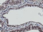 MIPEP Antibody in Immunohistochemistry (Paraffin) (IHC (P))