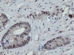 MIPEP Antibody in Immunohistochemistry (Paraffin) (IHC (P))