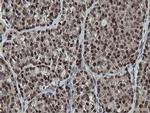 MIPEP Antibody in Immunohistochemistry (Paraffin) (IHC (P))