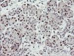 RFC2 Antibody in Immunohistochemistry (Paraffin) (IHC (P))