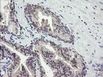 FBXO42 Antibody in Immunohistochemistry (Paraffin) (IHC (P))