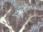 FBXO42 Antibody in Immunohistochemistry (Paraffin) (IHC (P))