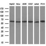 METAP2 Antibody in Western Blot (WB)