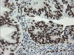 TLE1 Antibody in Immunohistochemistry (Paraffin) (IHC (P))