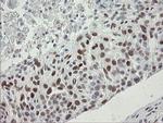 TLE1 Antibody in Immunohistochemistry (Paraffin) (IHC (P))