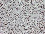 TLE1 Antibody in Immunohistochemistry (Paraffin) (IHC (P))