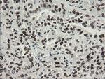 TLE1 Antibody in Immunohistochemistry (Paraffin) (IHC (P))