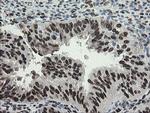 TLE1 Antibody in Immunohistochemistry (Paraffin) (IHC (P))