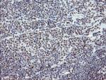 TLE1 Antibody in Immunohistochemistry (Paraffin) (IHC (P))