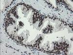 TLE1 Antibody in Immunohistochemistry (Paraffin) (IHC (P))