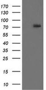 RIP1 Antibody in Western Blot (WB)