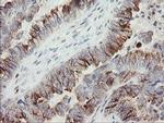 PHKG2 Antibody in Immunohistochemistry (Paraffin) (IHC (P))