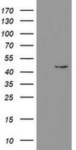 PHKG2 Antibody in Western Blot (WB)