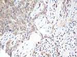 ARL2BP Antibody in Immunohistochemistry (Paraffin) (IHC (P))