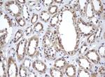 A4GNT Antibody in Immunohistochemistry (Paraffin) (IHC (P))