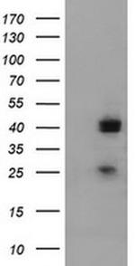 A4GNT Antibody in Western Blot (WB)