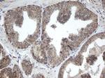 PPT1 Antibody in Immunohistochemistry (Paraffin) (IHC (P))