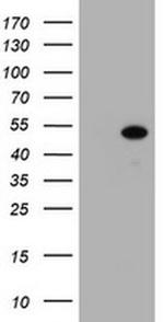 ZSCAN4 Antibody in Western Blot (WB)