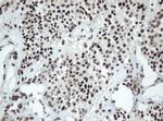 SF3A1 Antibody in Immunohistochemistry (Paraffin) (IHC (P))