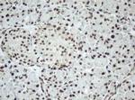 SF3A1 Antibody in Immunohistochemistry (Paraffin) (IHC (P))