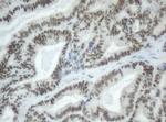 SF3A1 Antibody in Immunohistochemistry (Paraffin) (IHC (P))