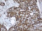 PPT1 Antibody in Immunohistochemistry (Paraffin) (IHC (P))