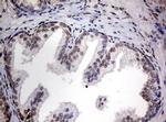 TIA-1 Antibody in Immunohistochemistry (Paraffin) (IHC (P))