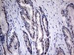 TIA-1 Antibody in Immunohistochemistry (Paraffin) (IHC (P))