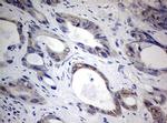 TIA-1 Antibody in Immunohistochemistry (Paraffin) (IHC (P))