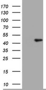 TIA-1 Antibody in Western Blot (WB)