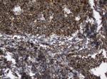 SERBP1 Antibody in Immunohistochemistry (Paraffin) (IHC (P))