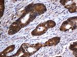 SERBP1 Antibody in Immunohistochemistry (Paraffin) (IHC (P))