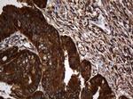 SERBP1 Antibody in Immunohistochemistry (Paraffin) (IHC (P))