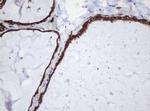 SERBP1 Antibody in Immunohistochemistry (Paraffin) (IHC (P))